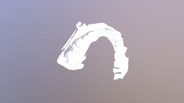 NTUH onlay 47 3D Model