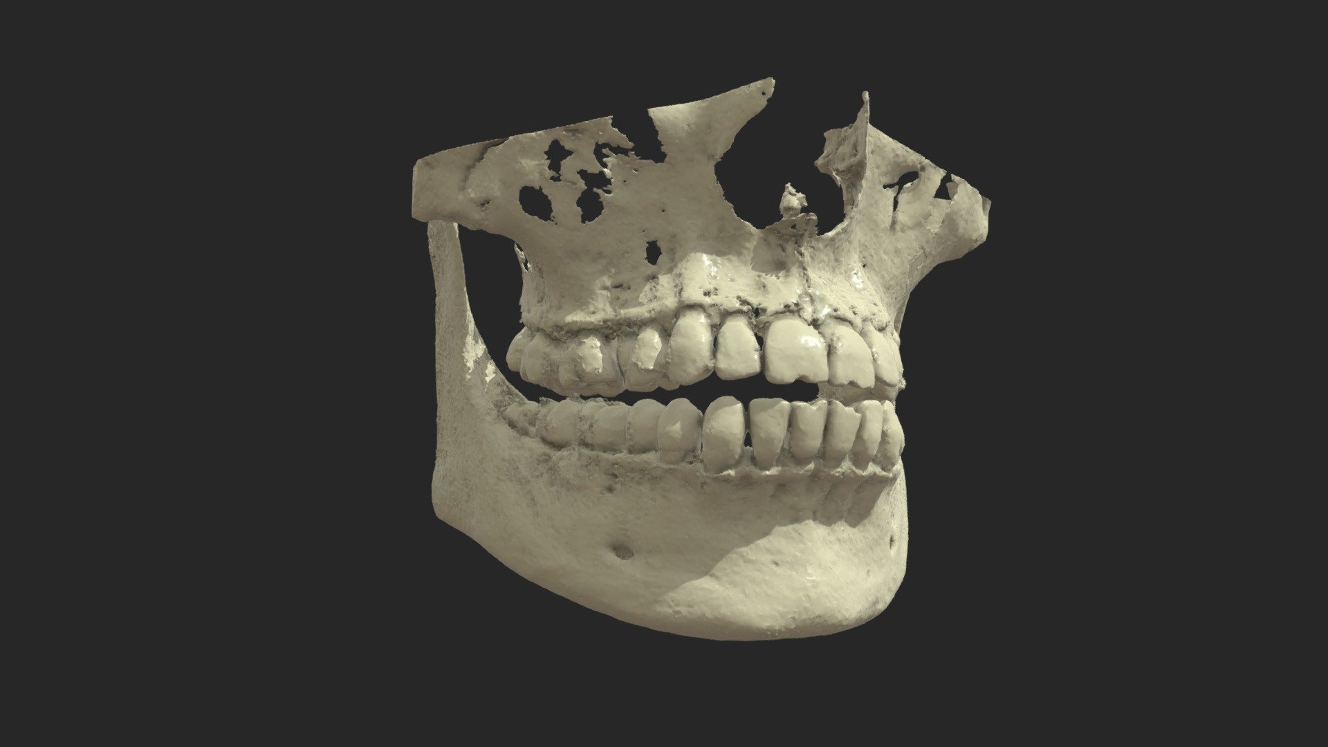 Skull Tomography