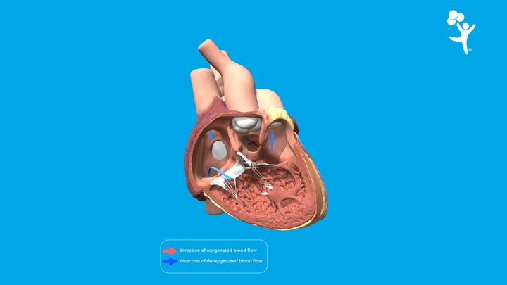 Double Outlet Right Ventricle 3D Model