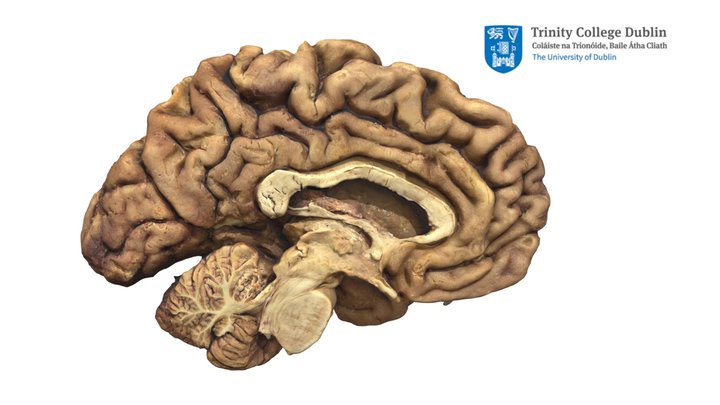 Diencephalon 3D Model