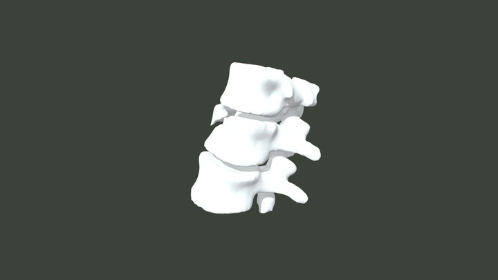 Bone_Druck 3D Model