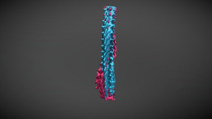 Straight and Curvy Spine Overlay Final 3D Model