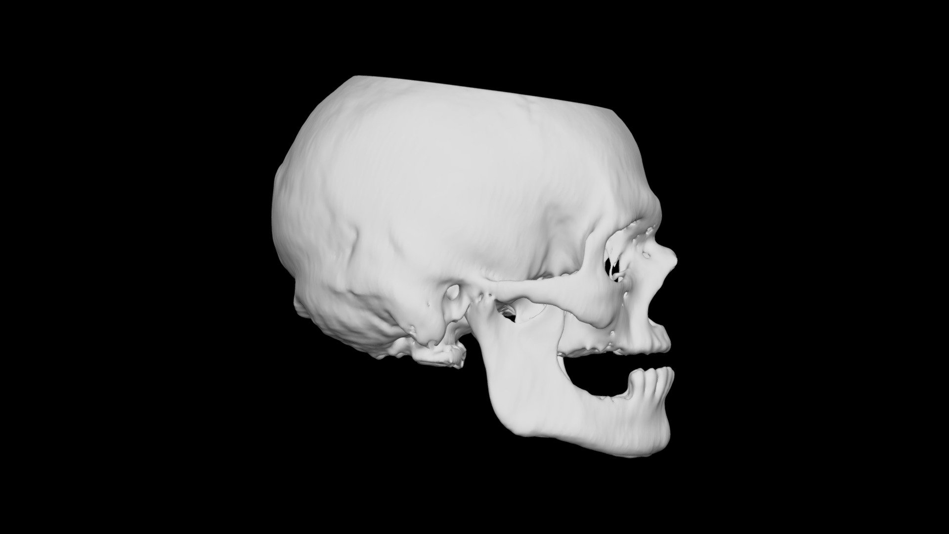 Skull Male 44yo