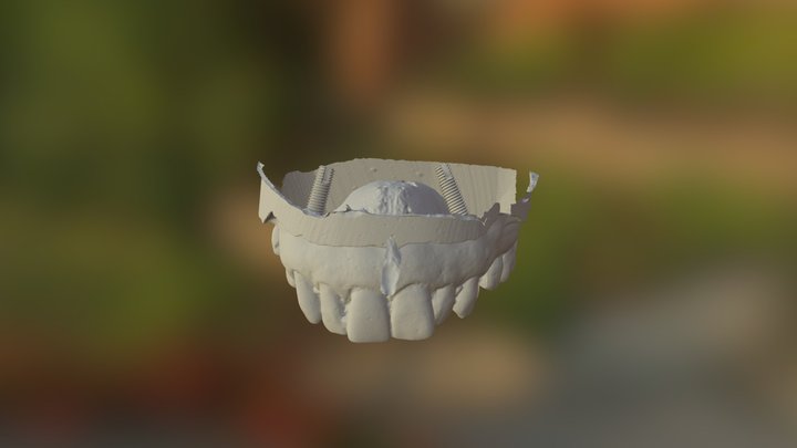 Model Implants Abutments 3D Model
