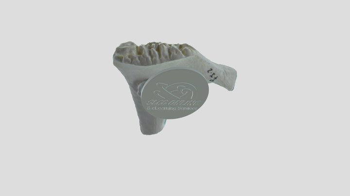 Pubic Symphysis I-2 3D Model