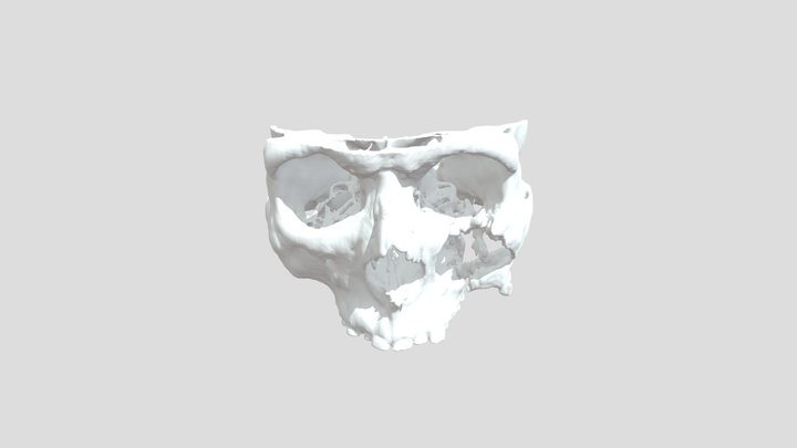 череп с травмой – Modelo 3D gratuito STL