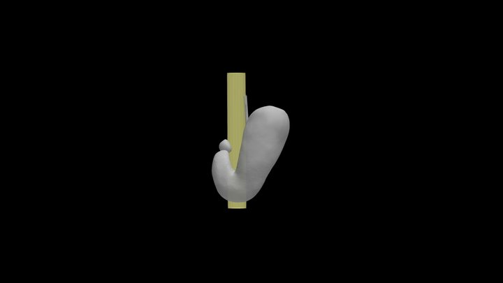 鉤状胃椎体あり（正面） 3D Model