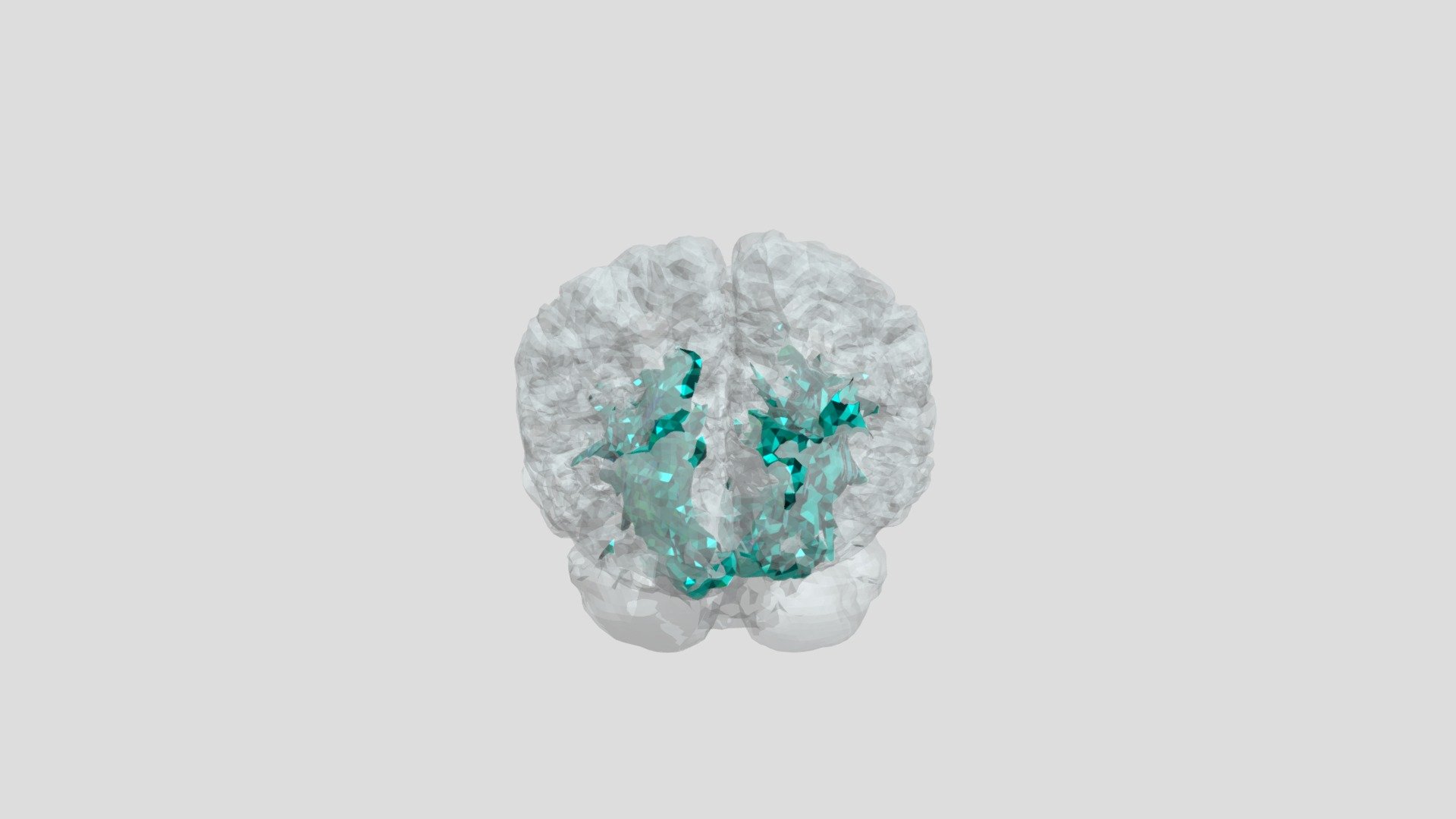 Your Inferior Fronto Occipital Fascicle — Sketchfab embed 3D viewer