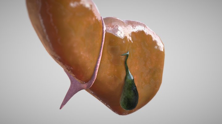 Fatty Liver 3D Model