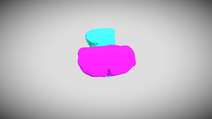 Rectum and Bladder 3D Model