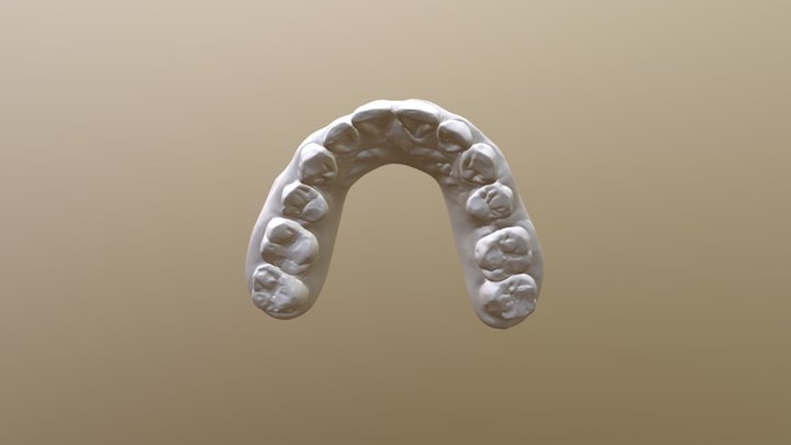 简兰-矫正后-上颚 3D Model