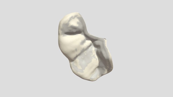 Onlay 3D Model
