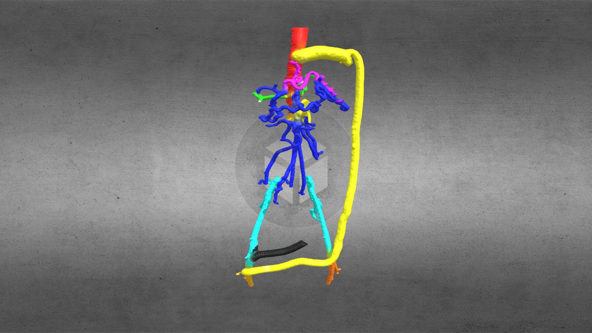 Aortic grafts