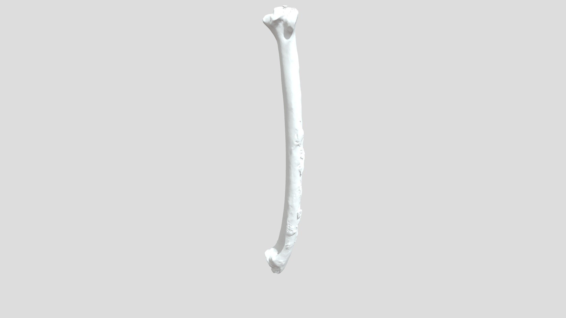 2052 B8 L Ulna