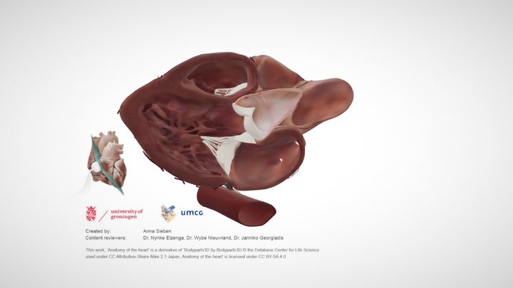 Cardiac Anatomy: Parasternal Long Axis – Kostenloses 3D-Modell STL