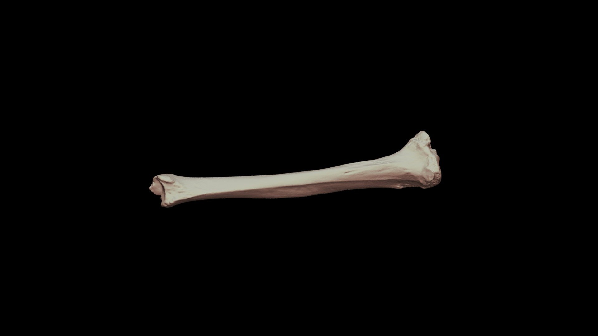 F154-4
