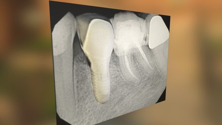 A New Way to See Radiographs 3D Model