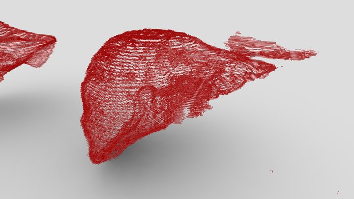 Liver CT scan segmentation 3D Model