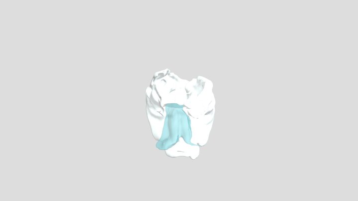 Fenda palatina 2 3D Model