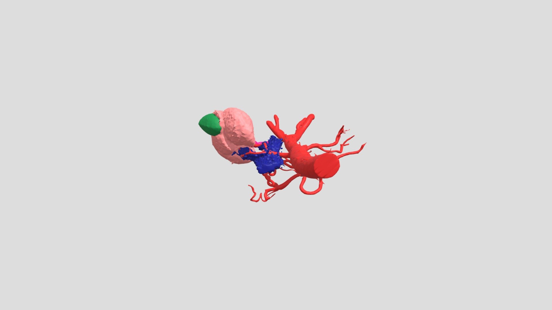 Kidney Model Weglarz