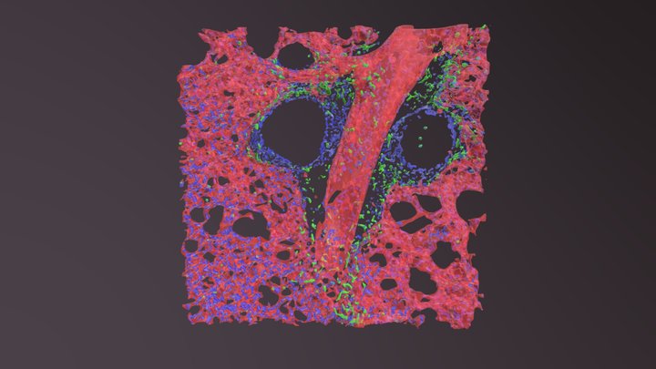 Perivascular macrophages in a filaria infection 3D Model