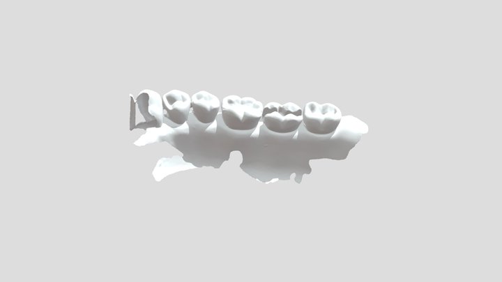 09082023-ODN 324 RCP MOD 47-maxilar 3D Model