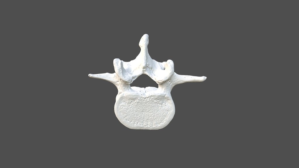 Lumbar Vertebra 3