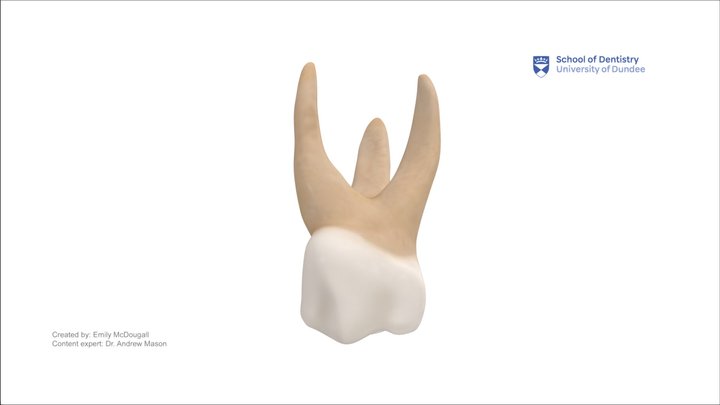 Primary upper left first molar (FDI 64) – Modello 3D gratuito STL