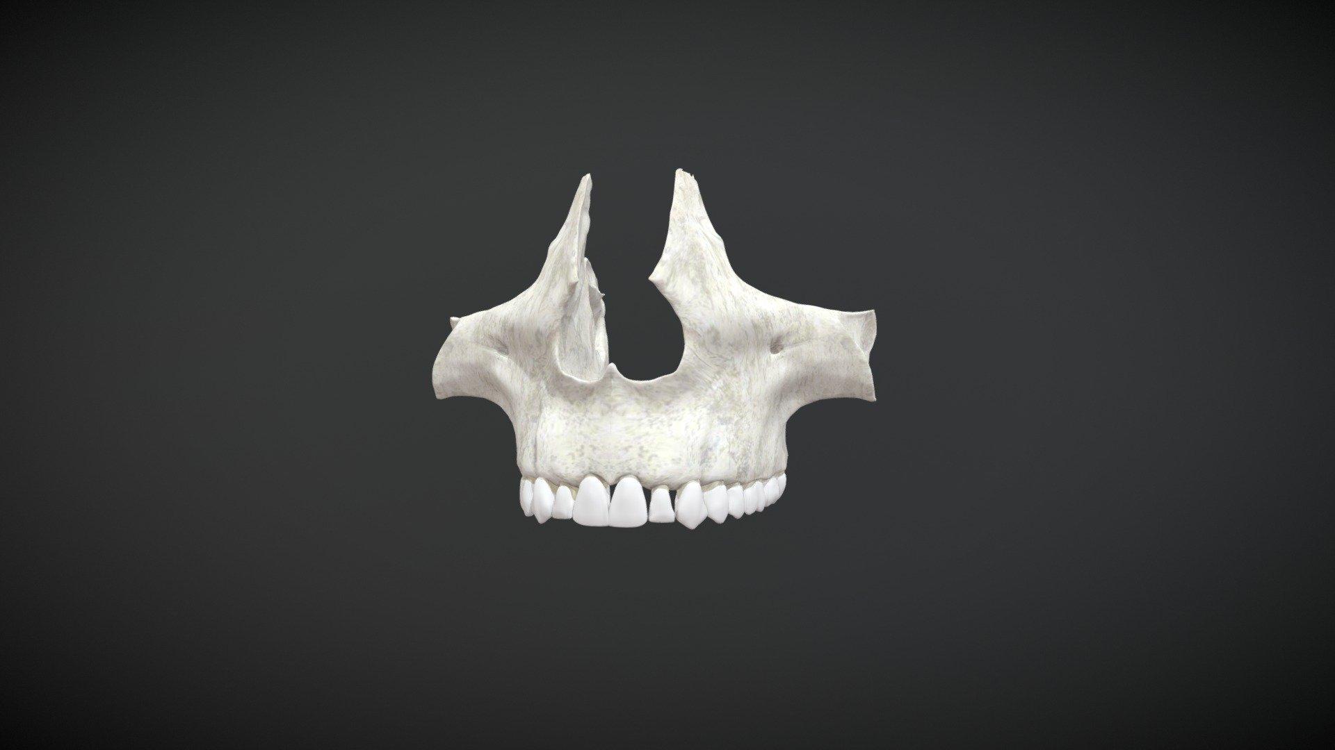 maxillary complete / Maxilar Doble