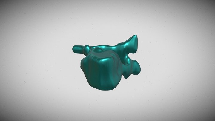 Segmentation_ Vertebra 3D Model