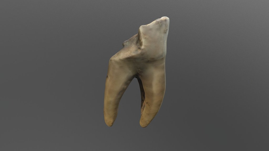 Decayed Tooth 2 - 3D model by diggingi95 [3aa5c39] - Sketchfab