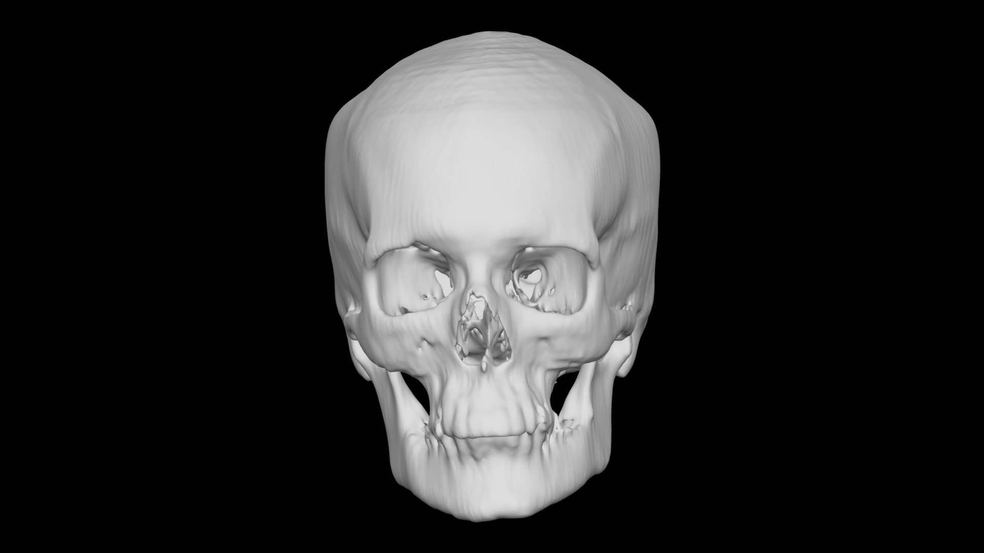 Skull Female 64yo