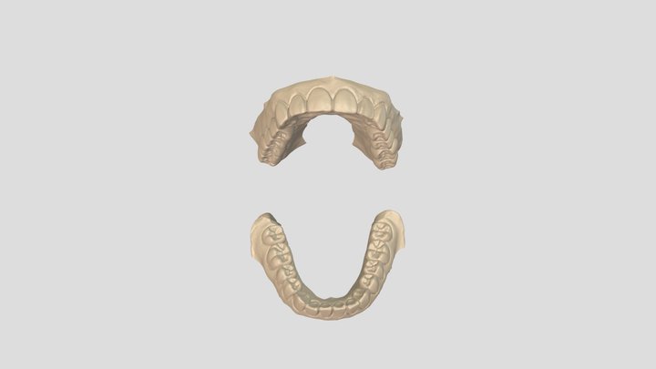 Full mouth wax-up 3D Model