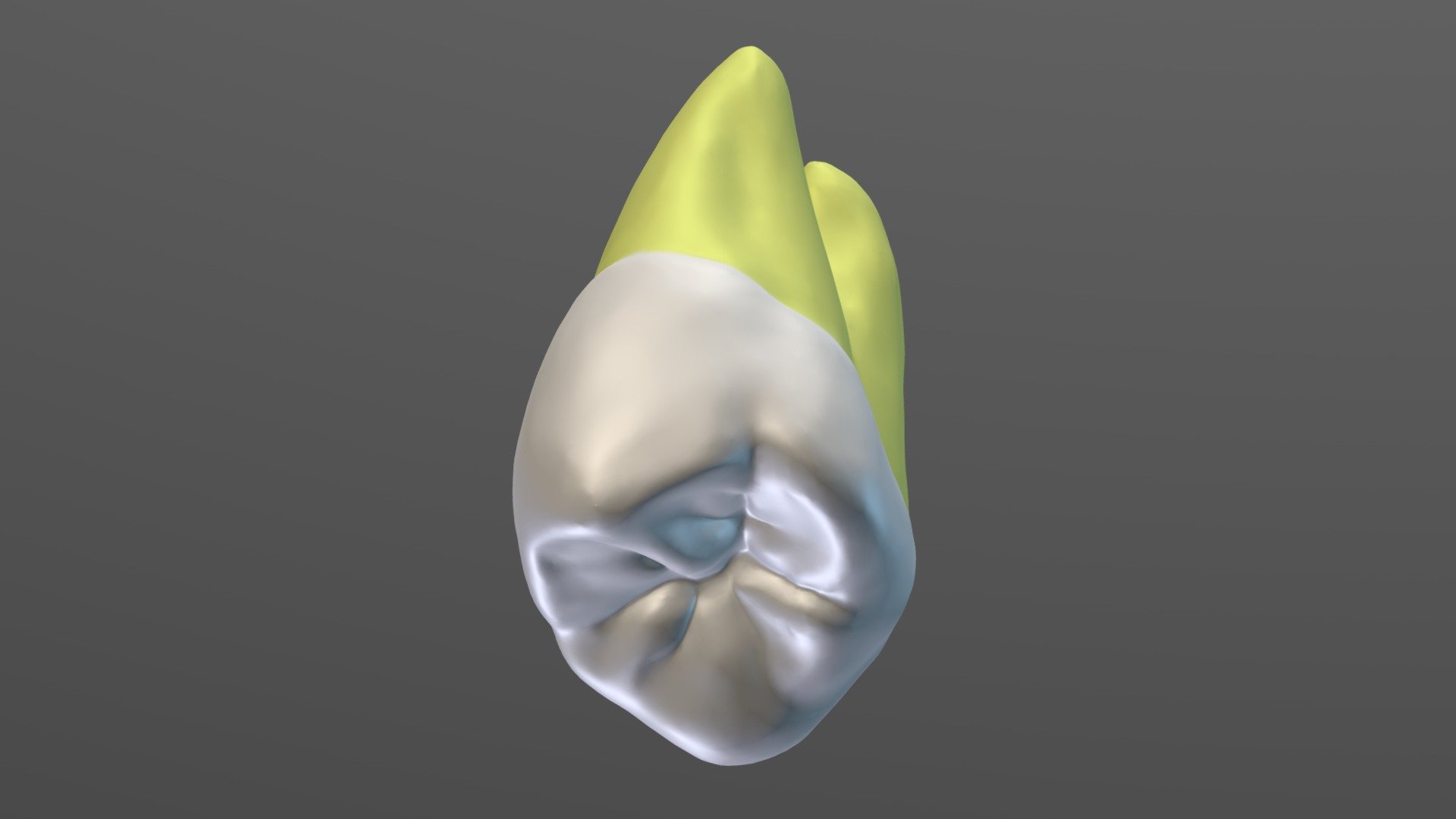 Maxillary Permanent Left Third Molar