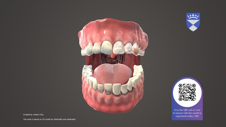 Chemicals & Element Exposure Pattern 3D Model