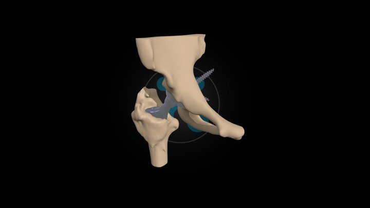 HumanX Medical Case Study #001