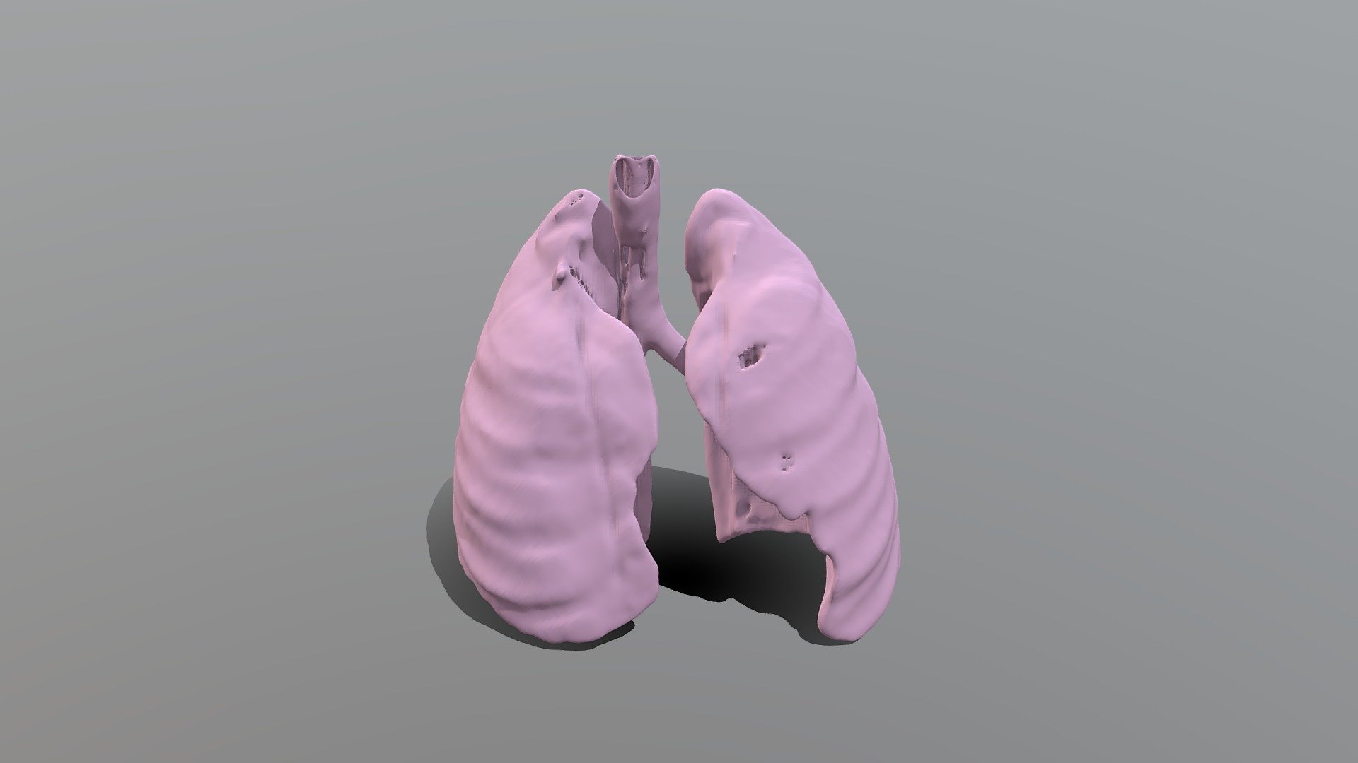 Lung Segmentation - Download Free 3D model by alejandros [3c00e4b ...