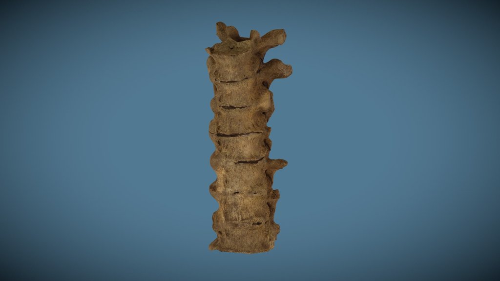 Skeletal Pathology - A 3D model collection by dmesser - Sketchfab