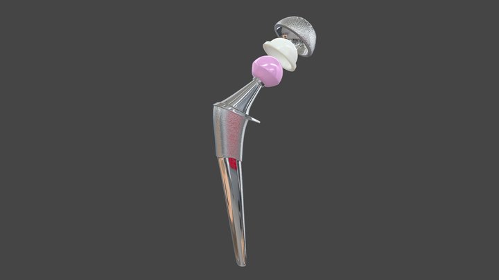 Prótese de Quadril 3D Model