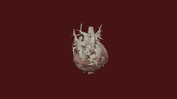 heart_abnormal 3D Model