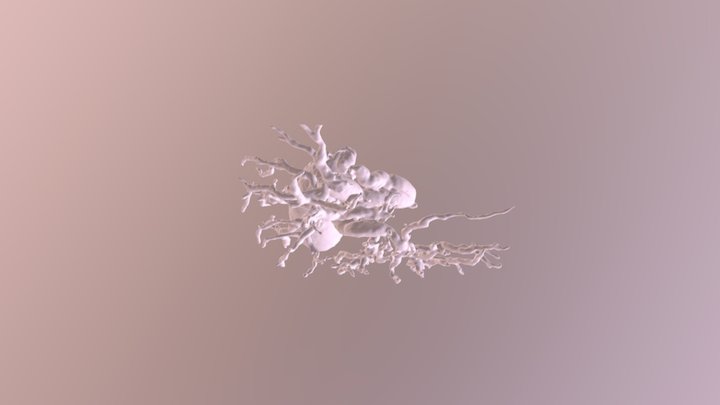 Biliary Mrcp - Test 3D Model