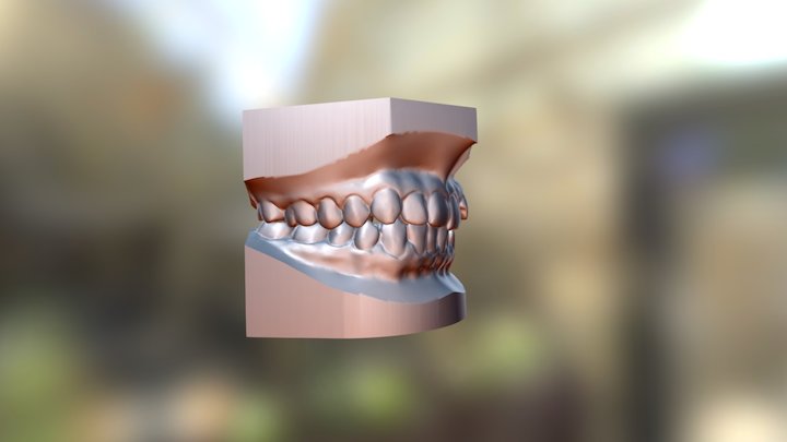 modelos de estudio ortodoncia 3D Model
