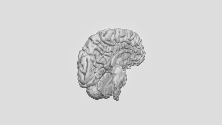 Human Left Brain Hemisphere from MRI 3D Model