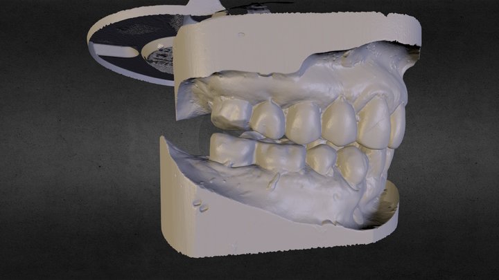 p.Neringa A. - jaws in centric relation 3D Model