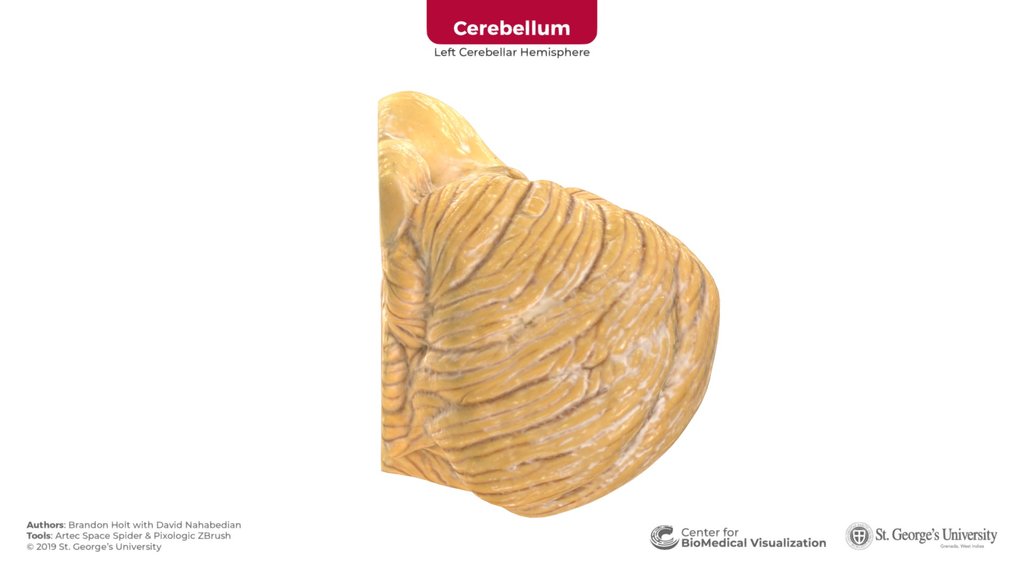cerebellum and brainstem - A 3D model collection by aherrler - Sketchfab