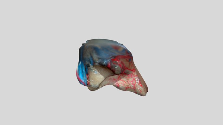 Supracerebellar approach 3D Model