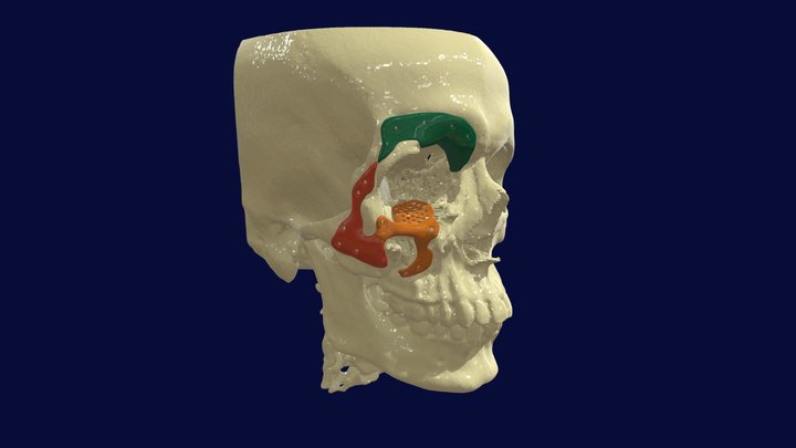 Case ID:30822680 3D Model
