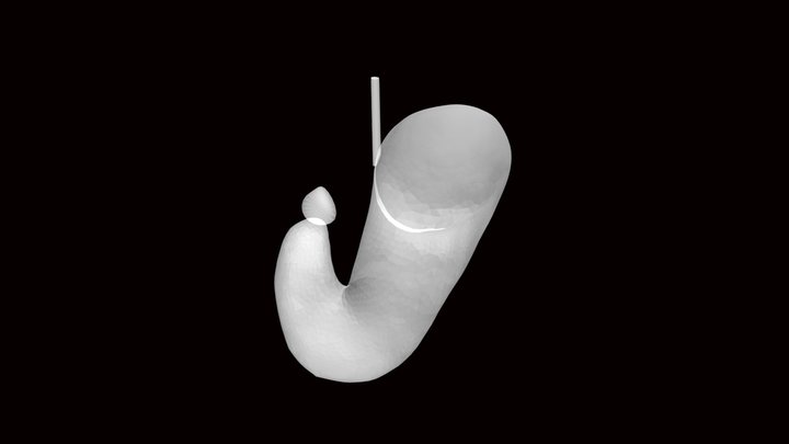 瀑状胃 3D Model