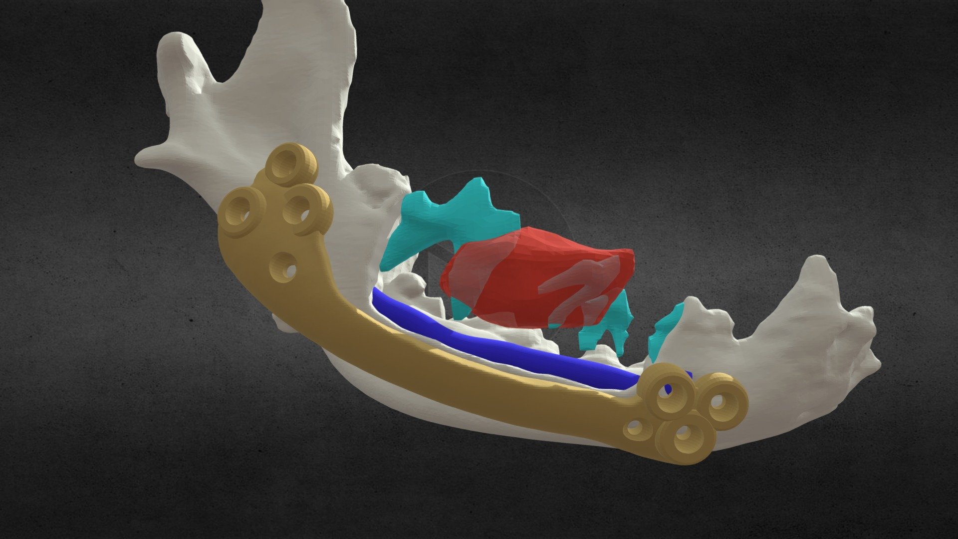 Tumor mandibular en canino