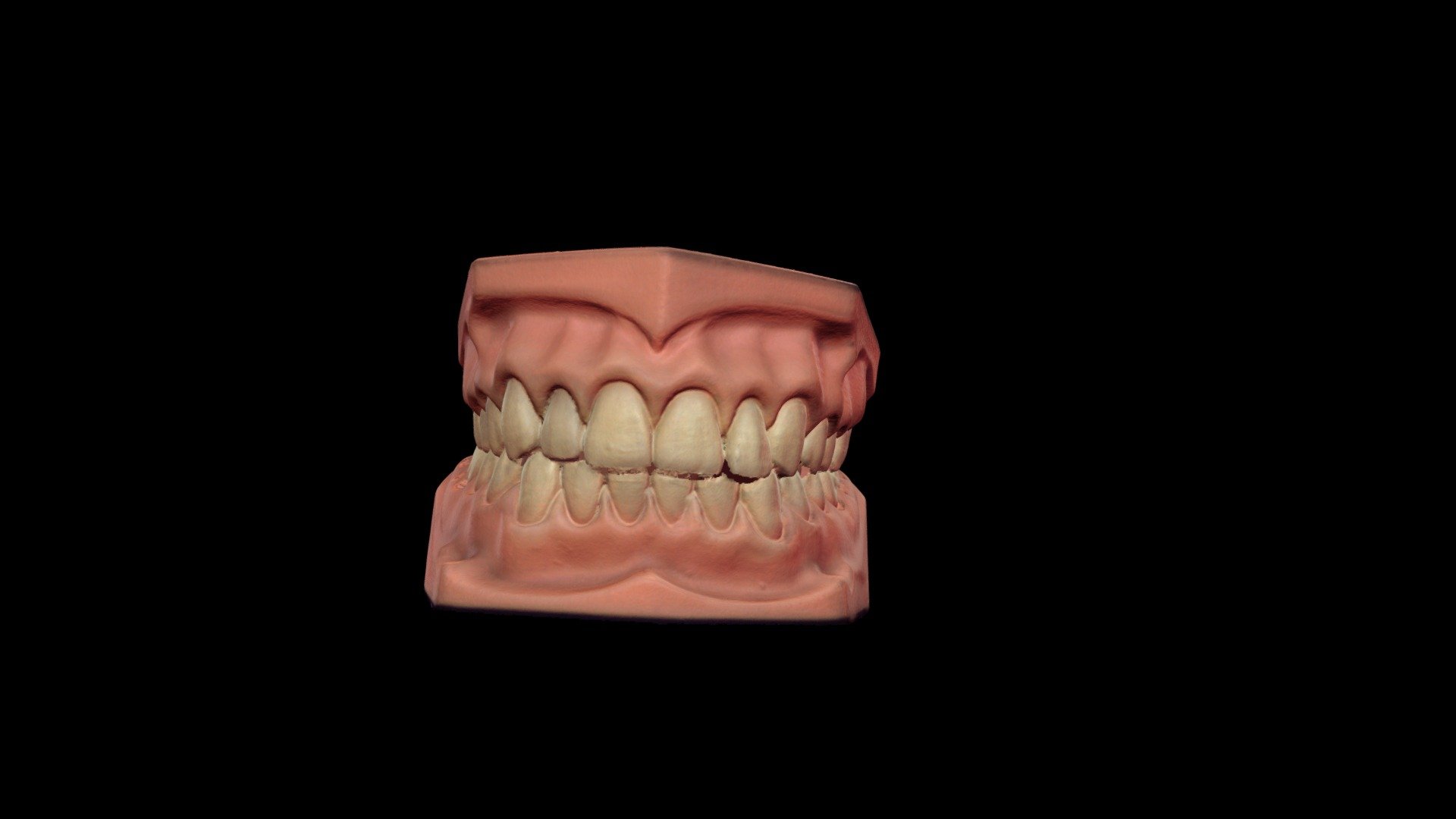 Jawscanupperandlower Download Free 3D model by